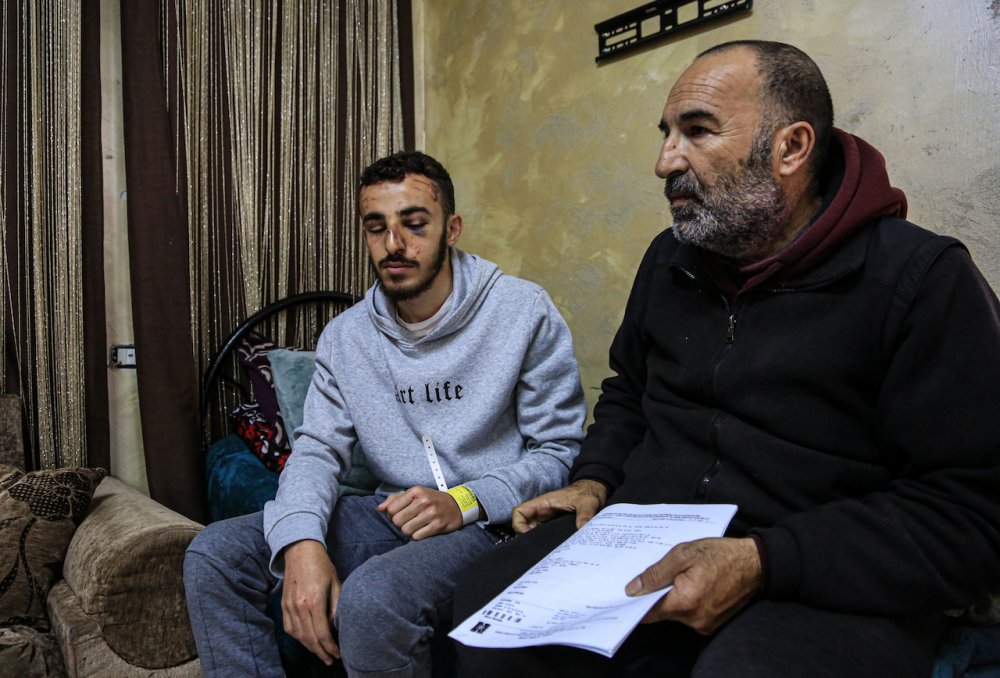 Mohammed Owaisat, 17, sits with a relative in his family’s home in Jabal Mukabbir, a Palestinian neighborhood in East Jerusalem, after he was beaten by Israeli soldiers, March 20, 2023.